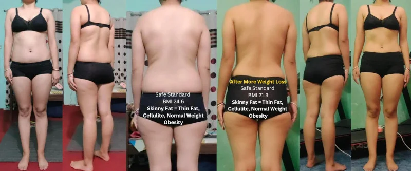 Cellulite, Thin Fat, Normal Weight Obesity - Research Participant 1170, The Four Body Types at Fellow One Research