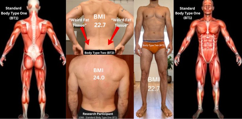 What Is Skinny Fat - BT2 compared to BT1 Front and Back, Example of Real Person Experiencing Real Skinny Fat