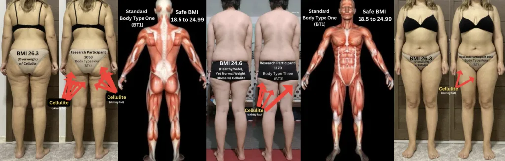 Cellulite Skinny Fat Examples Compared to Standard Body Type One (BT1) - Free Scientific Skinny Fat Test