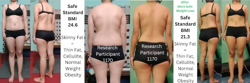 Skinny Fat Body Type Science - Research Participant 1170 Before and After Weight Loss, Skinny Fat Tissue (Thin Fat, Cellulite)
