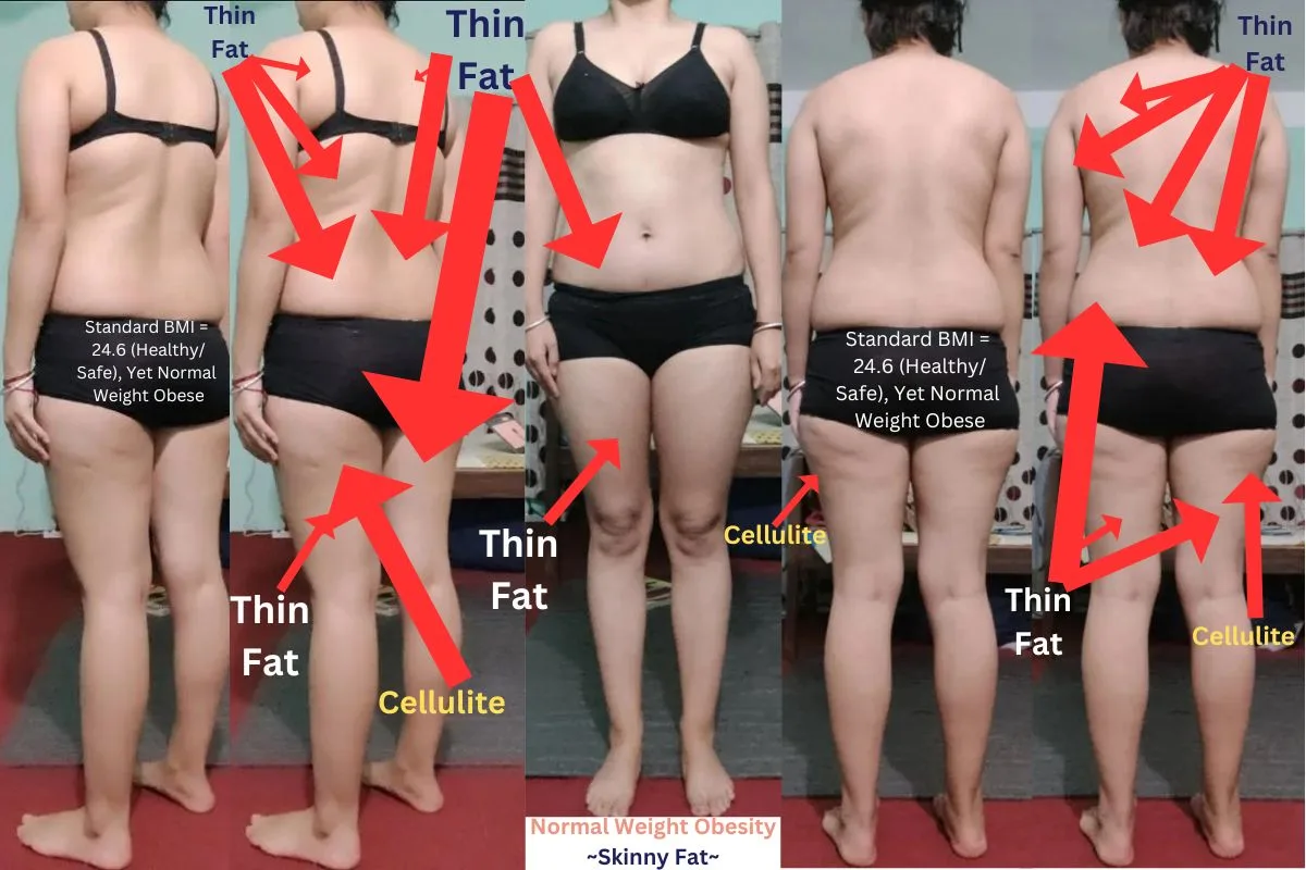 Research Participant 1170 - Before and After Skinny Fat Body