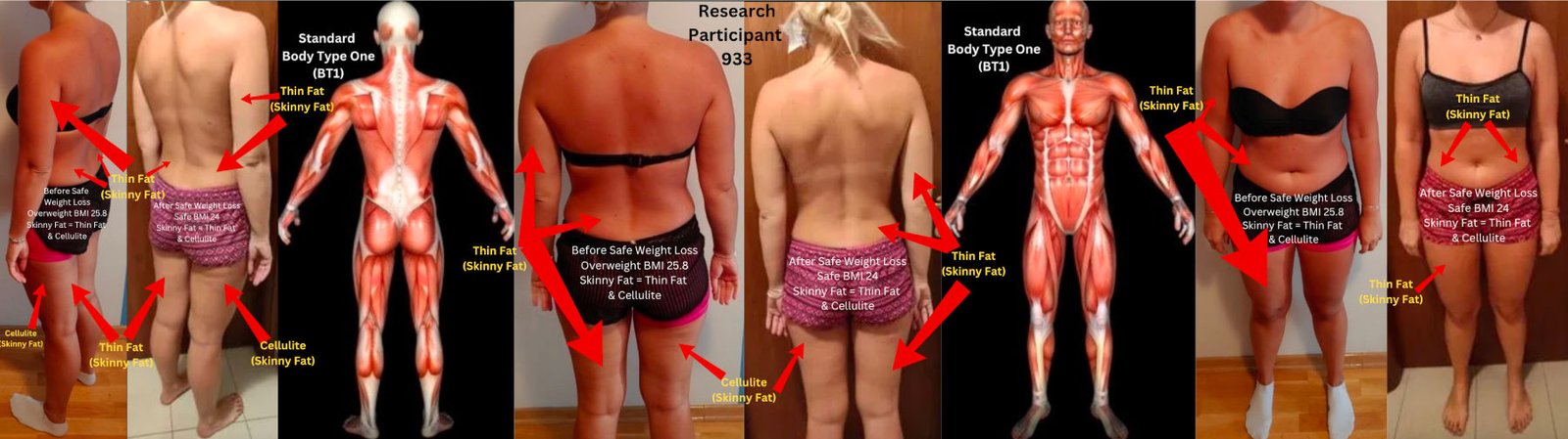 Research Participant 933 