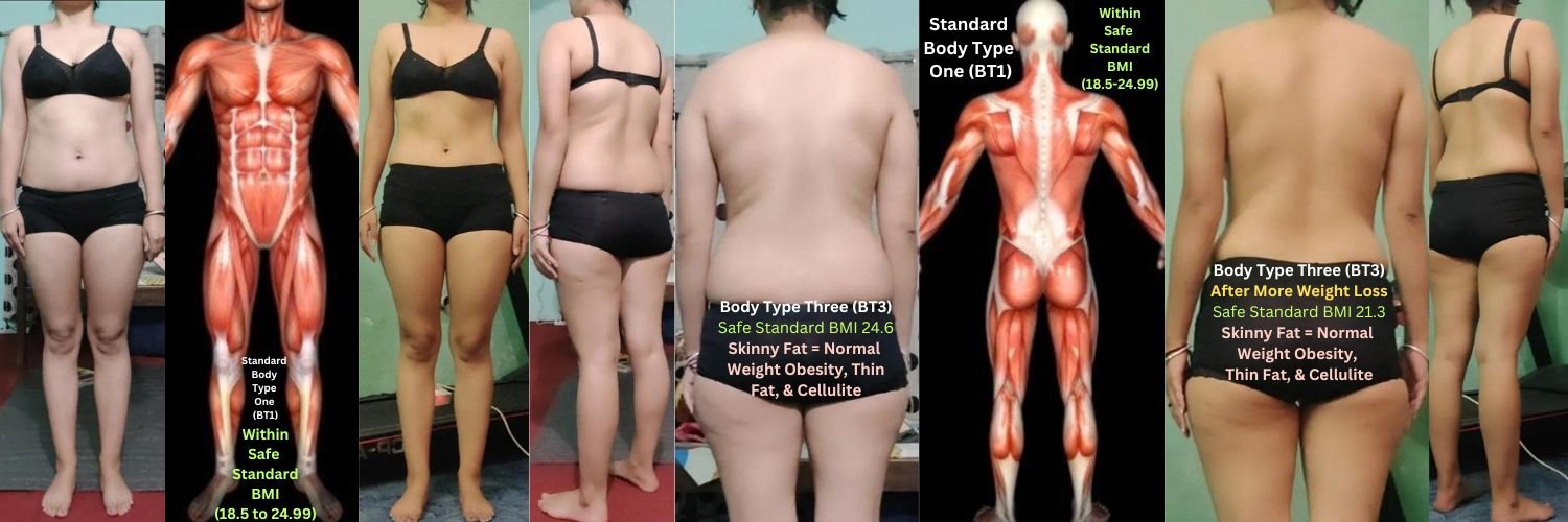 RP 1170 Before and After Regular Fat Weight Loss, Normal Weight Obesity