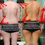 Skinny Fat Is More Than Just Normal-Weight Obesity