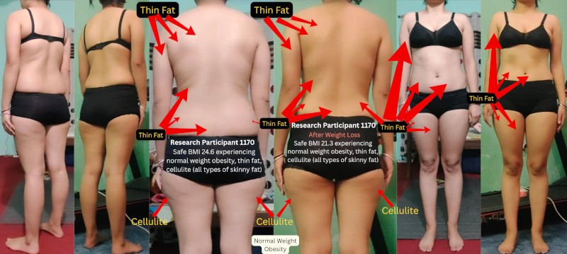 Skinny Fat Female with Low BMI - Research Participant 1170