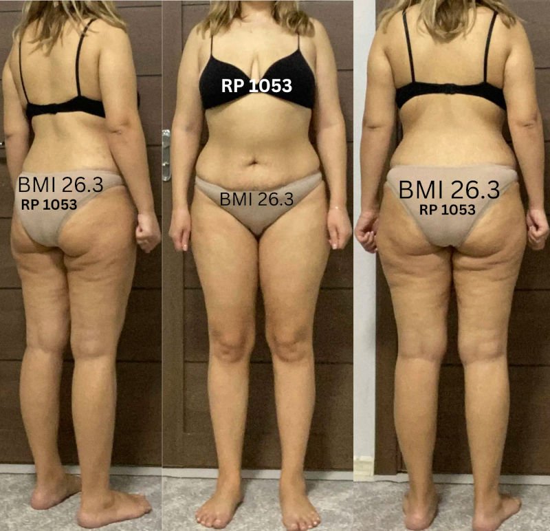 RP 1053 After Weight Loss