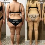 Skinny Fat Body Composition – Before & After Weight Loss