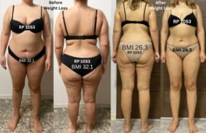 Skinny Fat Body Composition – Before & After Weight Loss