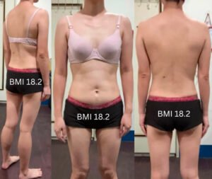 Skinny But Cellulite On Stomach – Skinny Fat Question