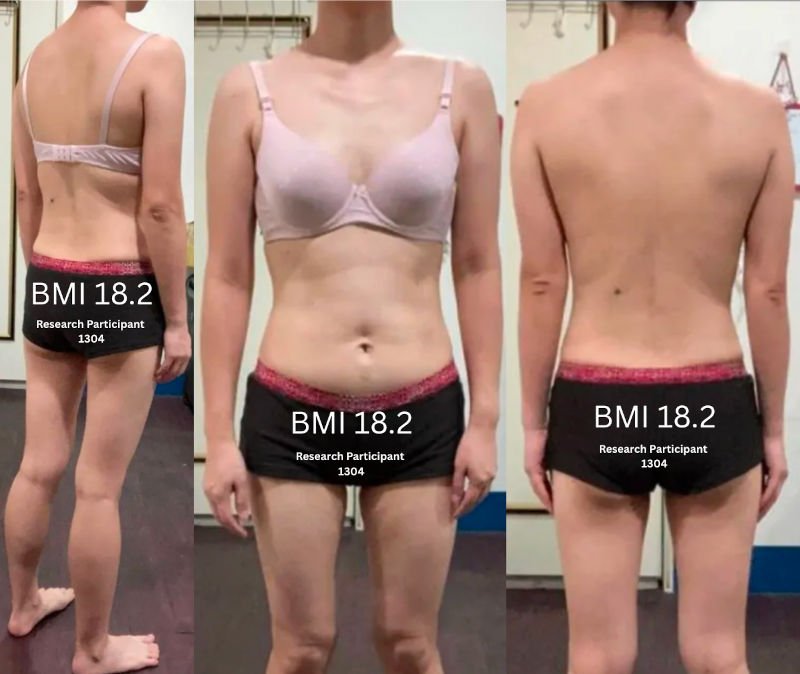 How Much Genetic Muscle Tissue Were You Born With or Without (Skinny Fat)?