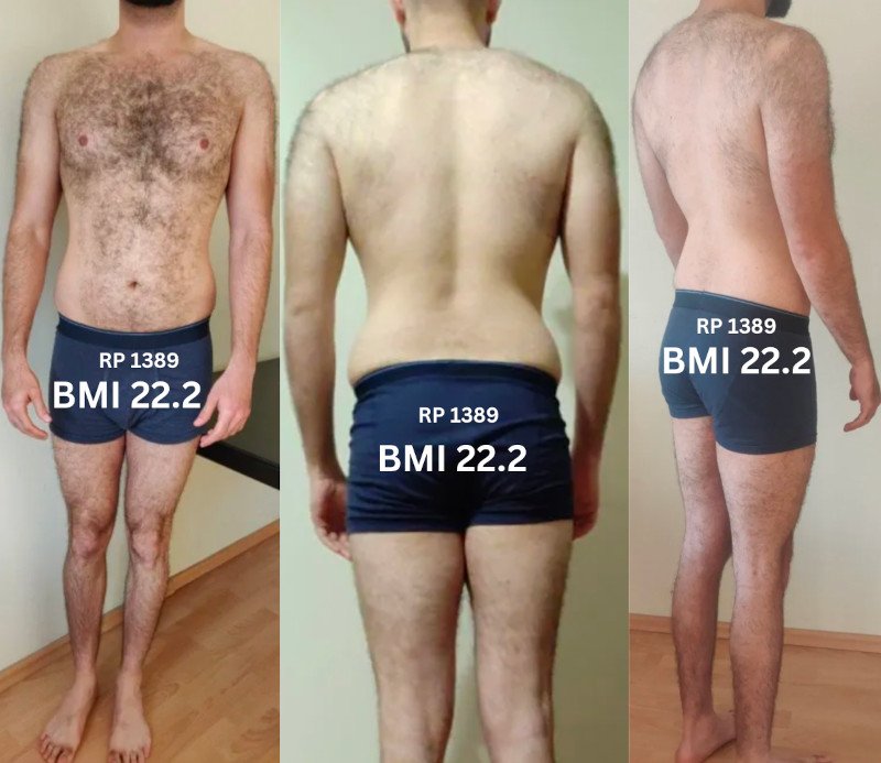 Research Participant 1389 - Skinny Fat (Thin Fat)
