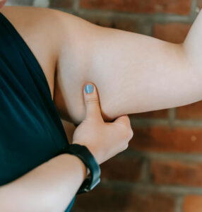 Why is My Skinny Fat Worse After Losing Weight with GLP1? – Question