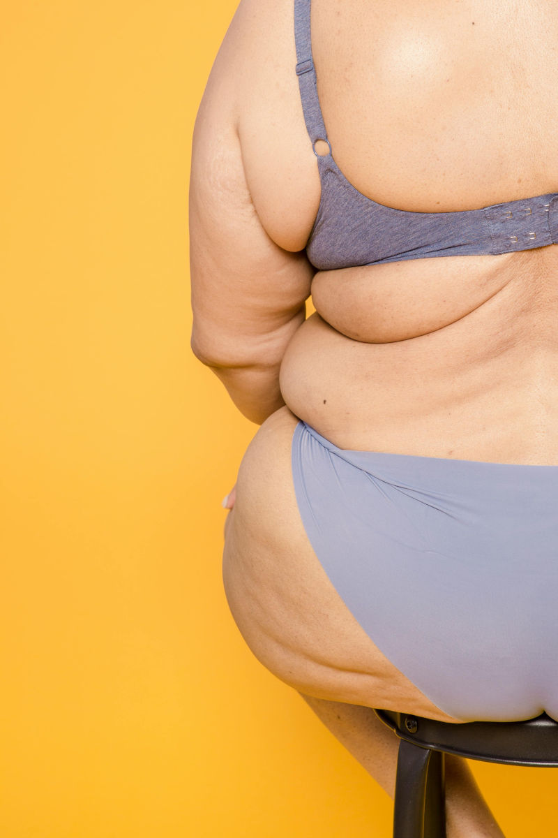 How Skinny Fat Affects Healthcare - Obesity