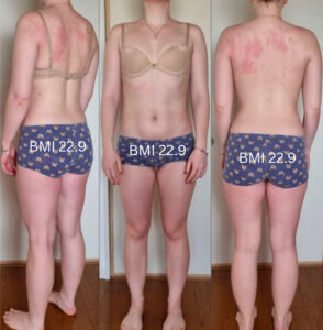 How Is Skinny Fat Measured? – Question