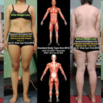 Skinny Fat: “Thin Fat”, Cellulite, and Deficient Muscle Skinny Fat: “Thin Fat”, Cellulite, and Deficient Muscle