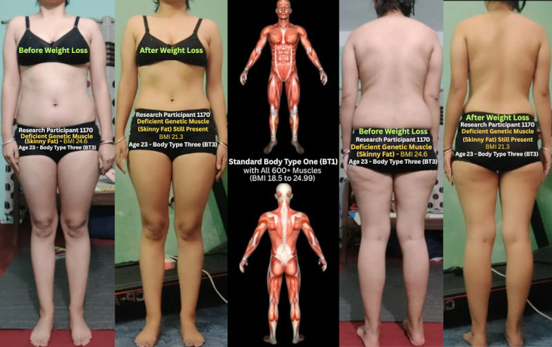 Skinny Fat: “Thin Fat”, Cellulite, and Deficient Muscle Skinny Fat: “Thin Fat”, Cellulite, and Deficient Muscle