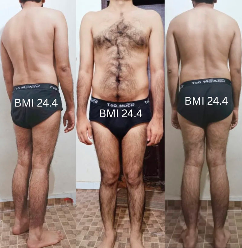 Is My Body Type Normal? – Skinny Fat Question