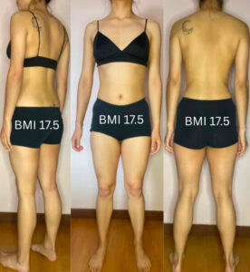 Is Skinny Fat Too Little Muscle or Too Much Fat? – Question